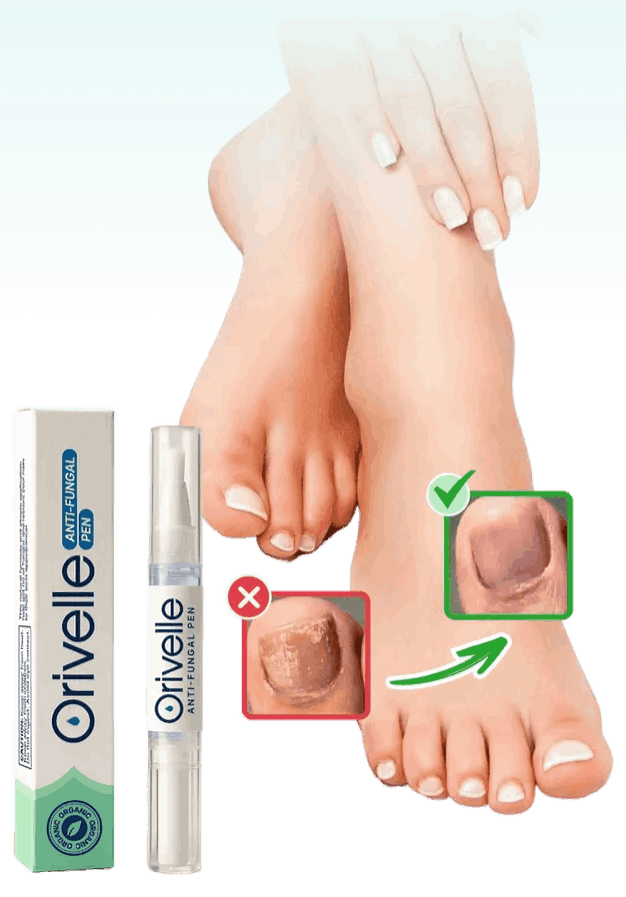 Orivelle Nail Fungus Pen – Official Sitei – Orivelli
